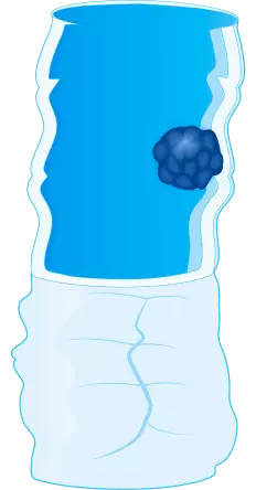 Стадия 1