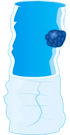 Стадия 2