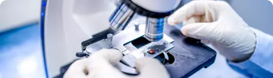 Тест на скрытую кровь в кале