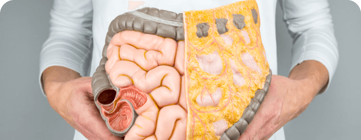 3 стадии принятия: как убедить себя в необходимости пройти колоноскопию