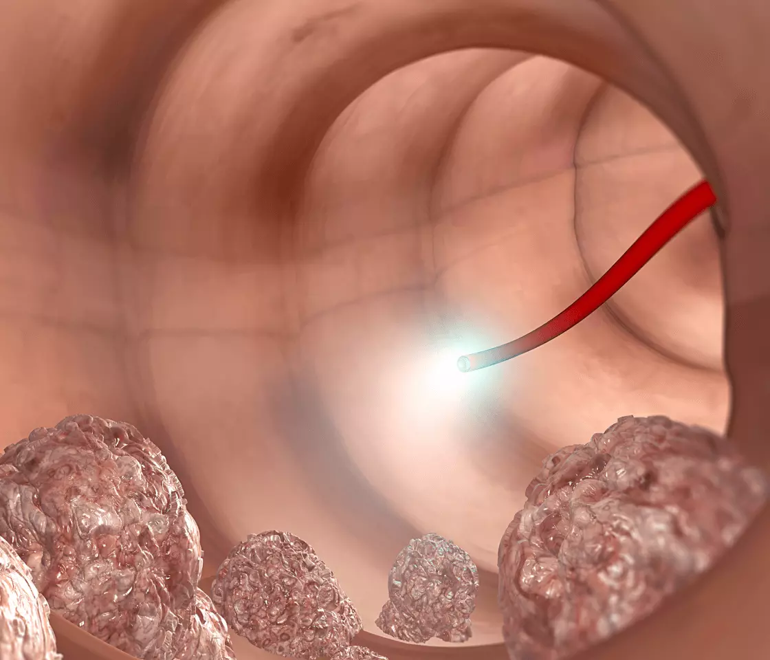 Плохая подготовка